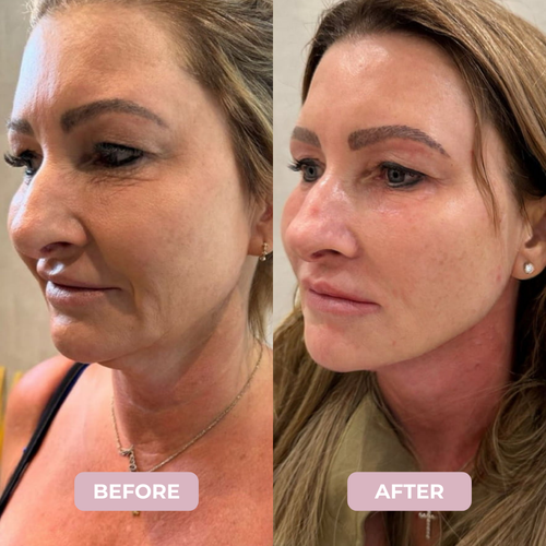 Camellia™ Collagen Lifting Mask