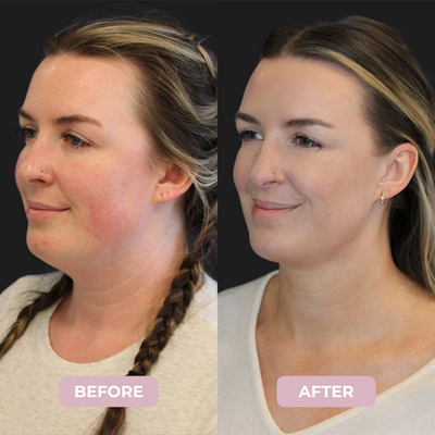 Camellia™ Collagen Lifting Mask