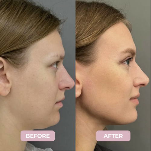 Camellia™ Collagen Lifting Mask